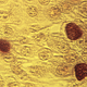 Chlamydia trachomatis.